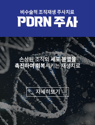 팝업3